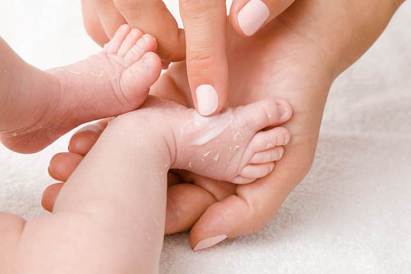 mother putting calamine lotion on baby's foot for mosquito bites