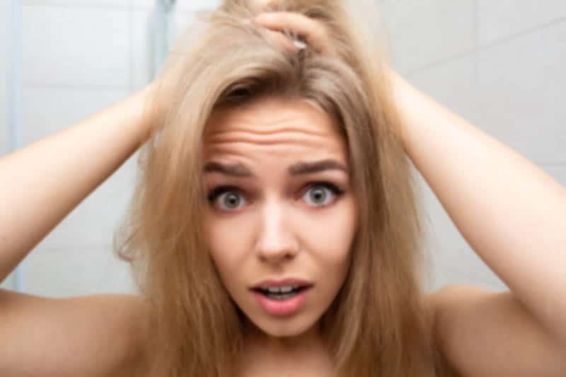 postpartum hair loss