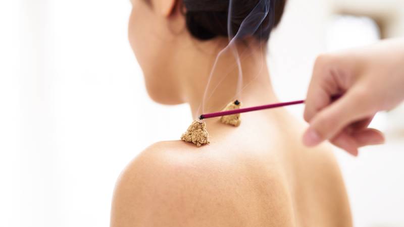 Moxibustion acupuncture needles heat on woman shoulder