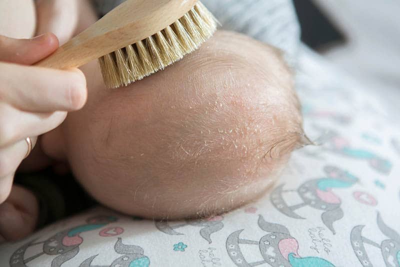 parent brushing baby head beacuse of a cradle cap