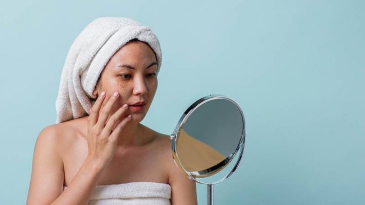 What Is A Pregnancy Mask (Melasma) & What Can You Do About It?