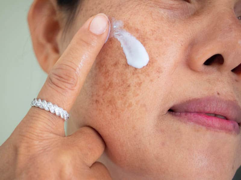woman putting cream on her face